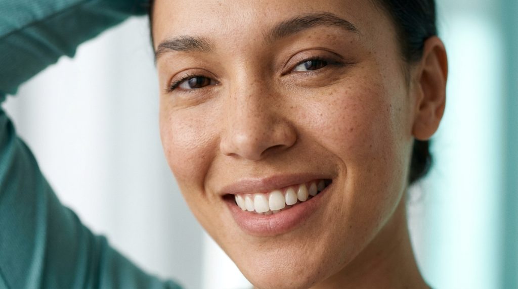 Radiant natural smile after a smile makeover in Turkey